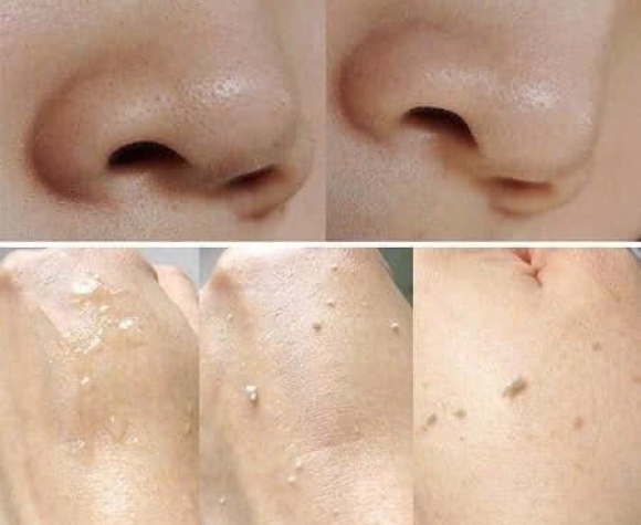 [Dr.Innoderm]_Tẩy Tế Bào Da Chết_Moisturizing Peeling Gelm_Sản phẩm chính hãng_Xuất VAT 100%